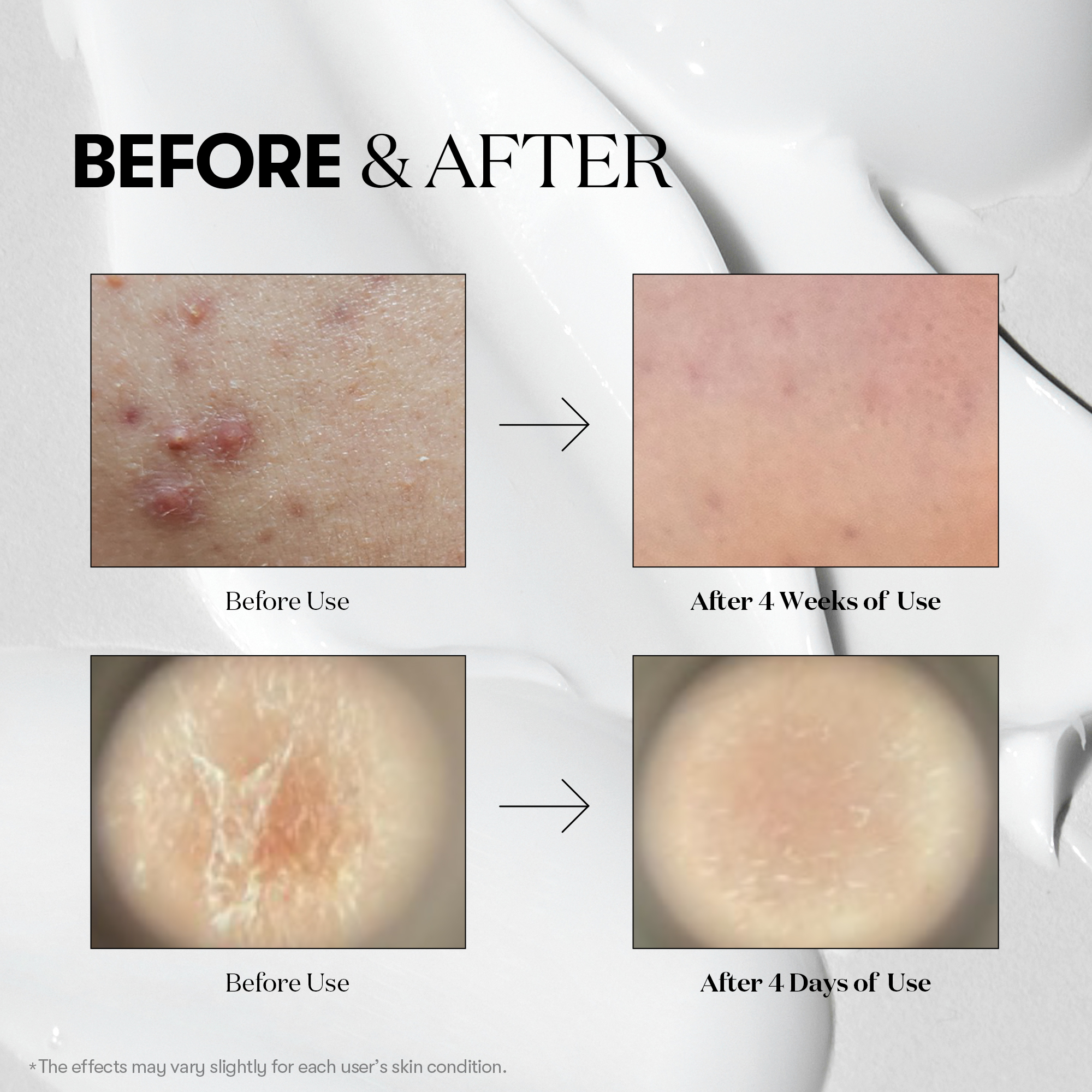 VT Color Reedleshot Starter Kit 3pk