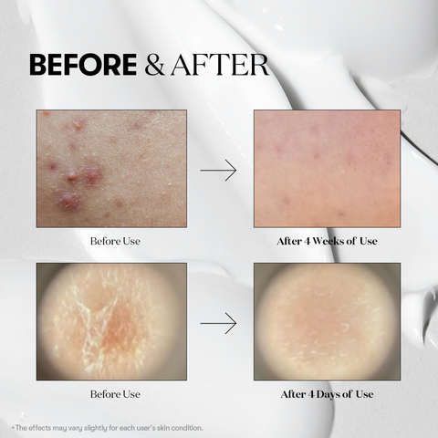 VT Color Reedleshot Starter Kit 3pk