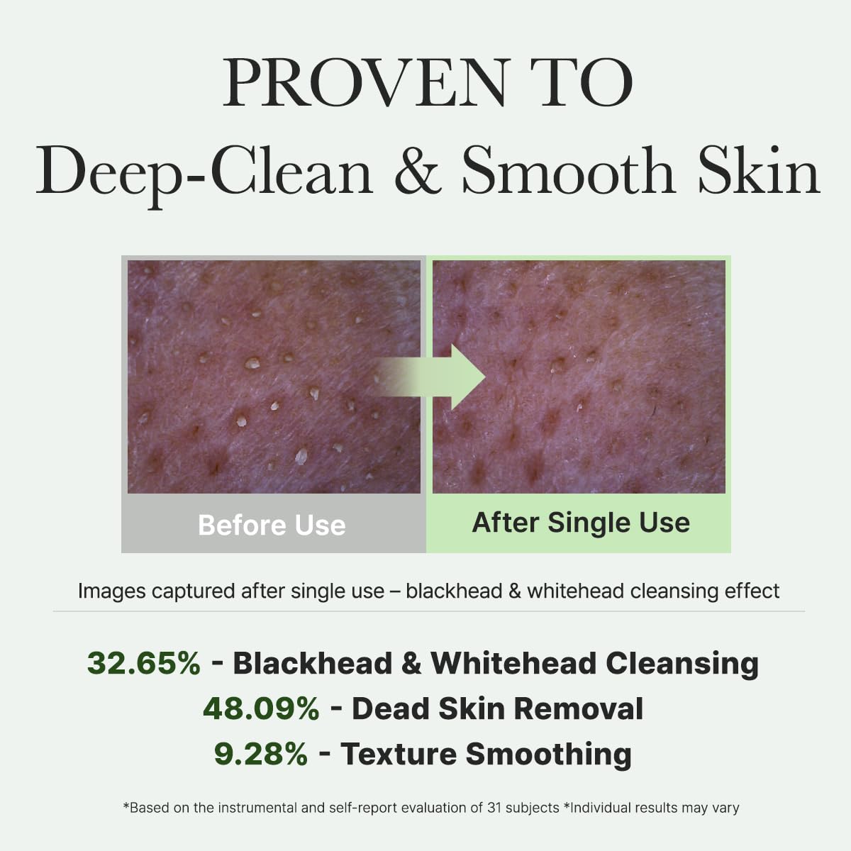 Proven to deep clean and smooth skin. 32.65% blackhead and whitehead cleansing. 48.09% dead skin removal. 9.28% texture smoothing. Images captured after single use - blackhead and whitehead cleansing effect. 