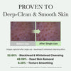 Proven to deep clean and smooth skin. 32.65% blackhead and whitehead cleansing. 48.09% dead skin removal. 9.28% texture smoothing. Images captured after single use - blackhead and whitehead cleansing effect. 