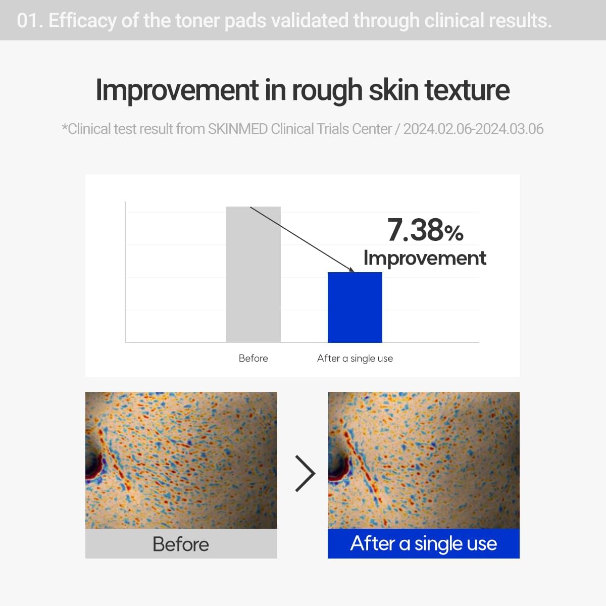 Efficacy of the toner pads validated through clinical results. 7.38% improvement in rough skin texture. Clinical test result from SKINMED Clinical Trials Center 2024.02.06-2024.03.06.