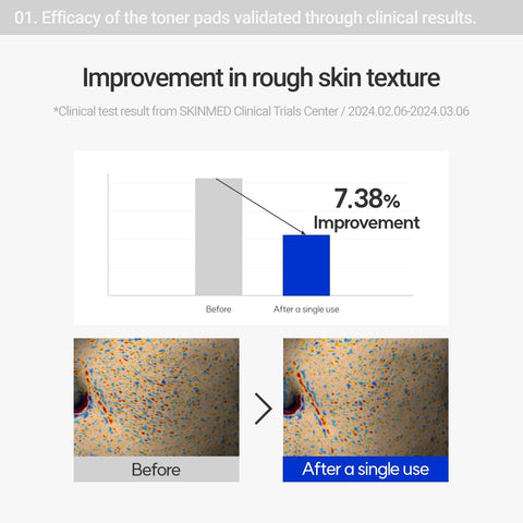 Efficacy of the toner pads validated through clinical results. 7.38% improvement in rough skin texture. Clinical test result from SKINMED Clinical Trials Center 2024.02.06-2024.03.06.