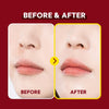 Before and after
