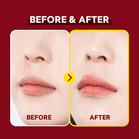 Before and after