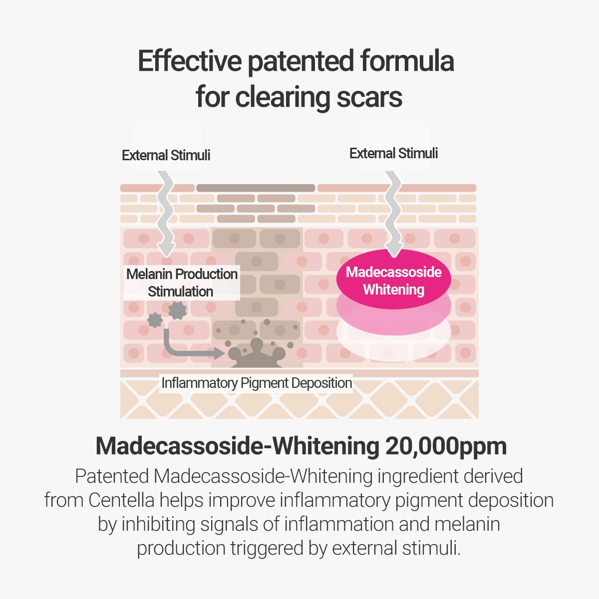 Effective patented formula for clearing scars. Madecassoside-whitening 20,000 ppm. Patented Madecassoside-whitening ingredient derived from centella helps improve inflammatory pigment deposition by inhibiting signals of inflammation and melanin production triggered by external stimuli. 