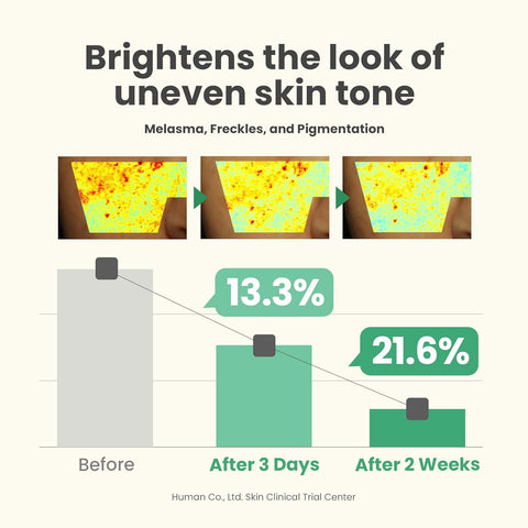 Clinical trial results showing brightening of uneven skin tone, melasma, freckles, and pigmentation after using AXIS-Y Dark Spot Correcting Glow Serum. Three comparison images display skin improvement over time: before use, after 3 days (13.3% improvement), and after 2 weeks (21.6% improvement). A bar chart visually shows reduced pigmentation levels over the same timeline.