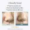 Clinically Tested. Safe for sensitive skin. Removes blackhead by 13%. Hydration lasts for 48 hours. 